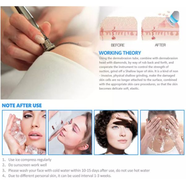 Dispositivo de peladura profundo facial del retiro de Diamond Microdermabrasion Machine Spray Wrinkle