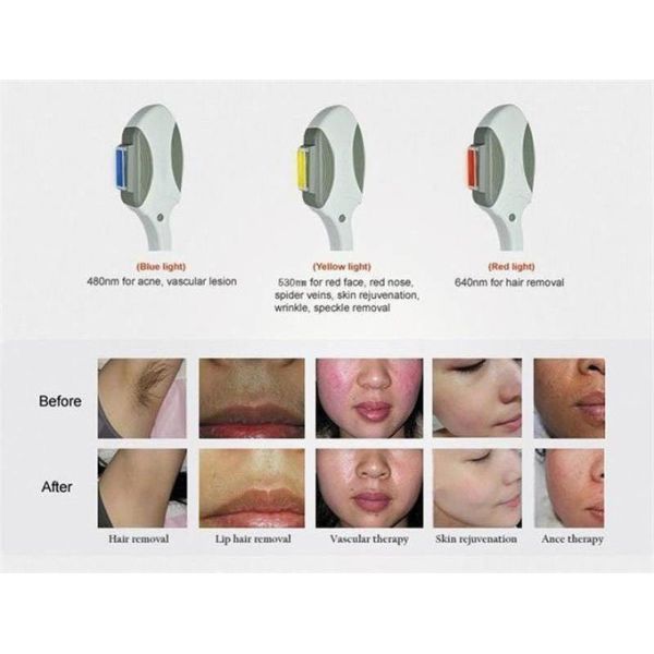 OPT SHR Epilation IPL Laser Hair Removal Machine 2000W 1-10Hz