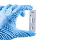 Kit de test rapide d'antigène du virus de la variole du singe de haute qualité