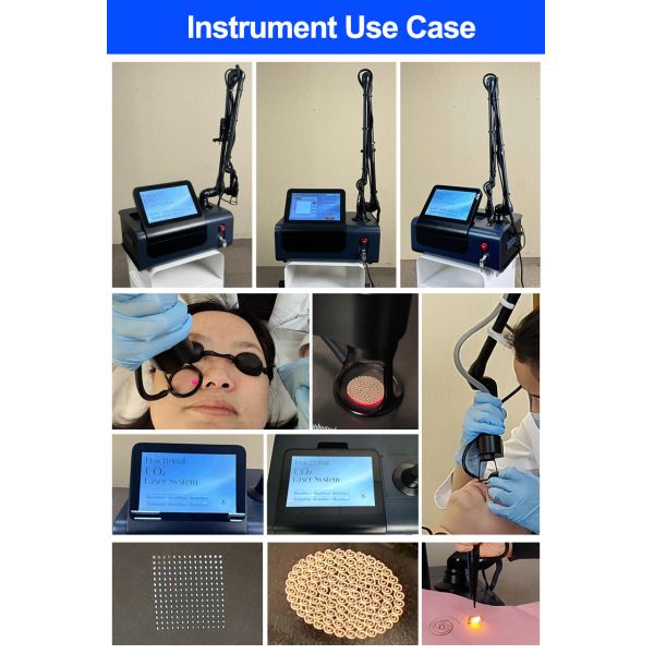 Pulse Stacking Technology 4 Working Heads Anti Aging 10600nm Fracational Co2 Laser Machine