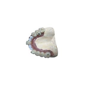 Coroa exata do implante do dente dos acessórios do implante dental de Biocompati