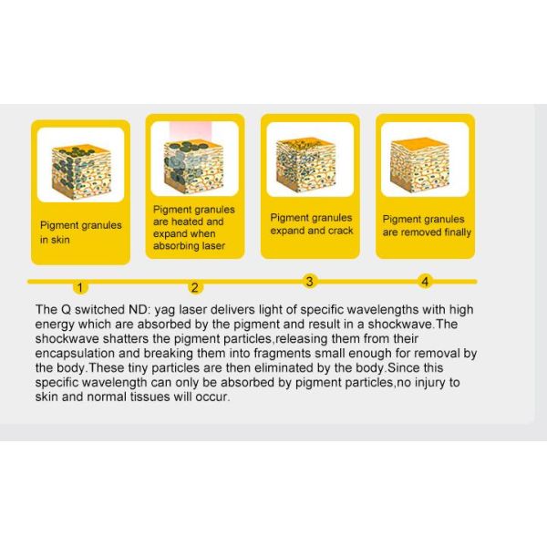 Effective Picosure Yag Laser Machine For Tattoo Removal Red / Gray Color Optional