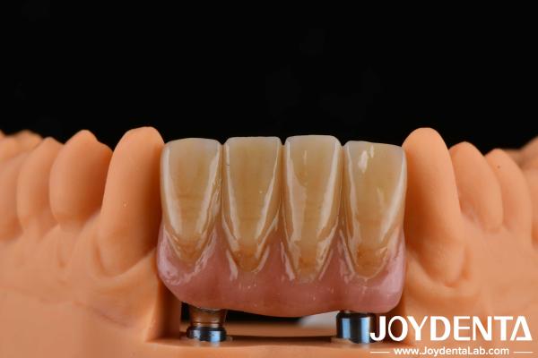 4.5mm Height Finished Abutments Internal Hex Connection Type Compatible With Implant Systems