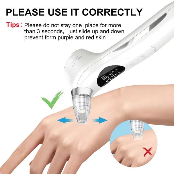 Vacuum Facial Blackhead Removal Suction Device Rechargeable Deep Pore Cleanser Machine