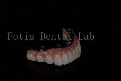 No Age Limit Affordable All On 6 Zirconia Implants Easy Maintenance