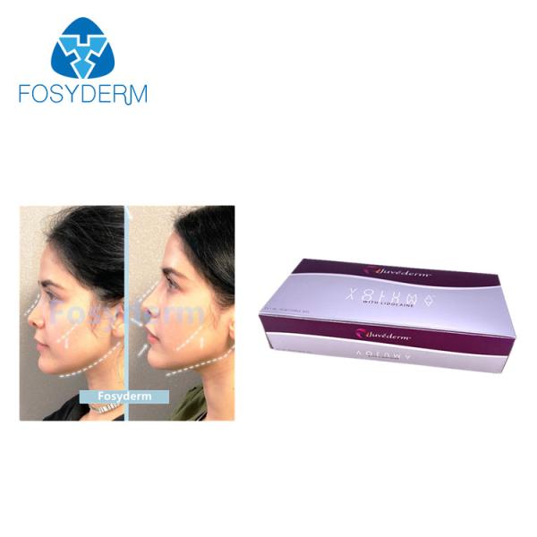 Realce ácido hialurónico do bordo dos enchimentos de Juvederm 2ml