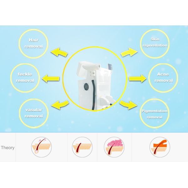Multi function SHR OPT E- Light Hair Removal Machine / Yag laser tattoo removal machine