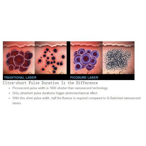 Vertical Laser Skin Rejuvenation Machine 532nm 1064nm 755nm 2-10mm Spot Diameter