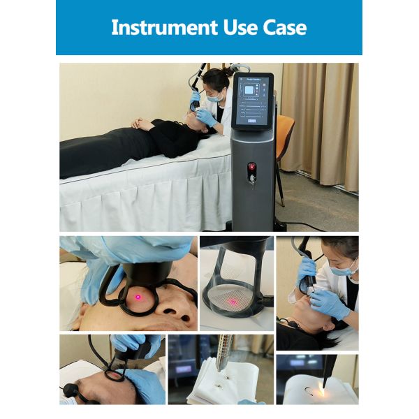 10600nm CO2 фракционная лазерная машина с 7 суставами Рука рубцовка / свертывание удаление Вагинальное лечение