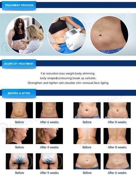 Nubway 5 handles cryolipolysis fat freeze slimming machine  FDA CE approved  80%  salon clinic used