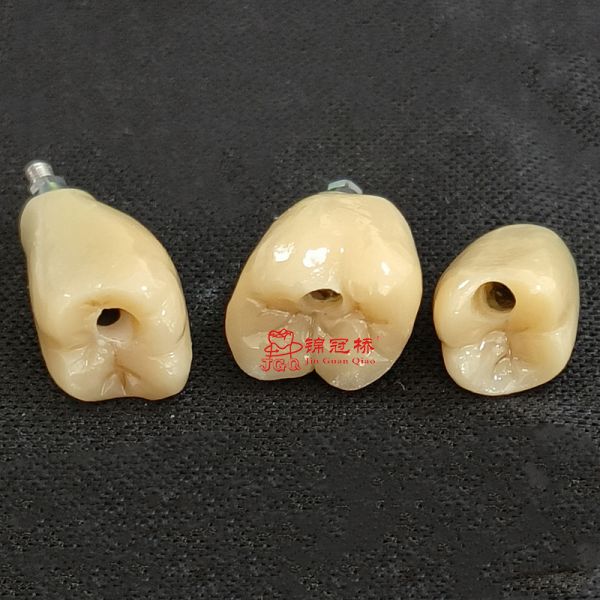 Dental Implant Supported Dentures Retentive Natural Looking Lab China