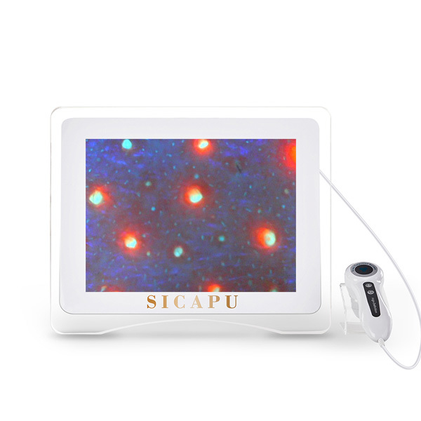 Analizador de piel HD de 15 pulgadas con aumento de 70x para equipos de análisis de piel en salones y spas