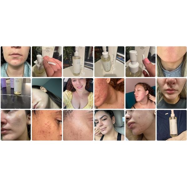 ODM Heartleaf Pore Control Moisturizing Facial Cleanser Oil For Face Makeup Blackhead Remover 6.76 Fl Oz