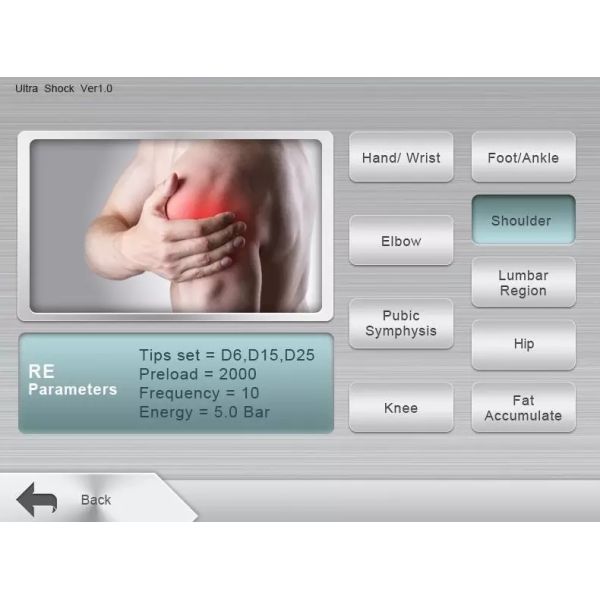 Облегчение боли машины терапией ударной волны ультразвука ESWT внекорпусное