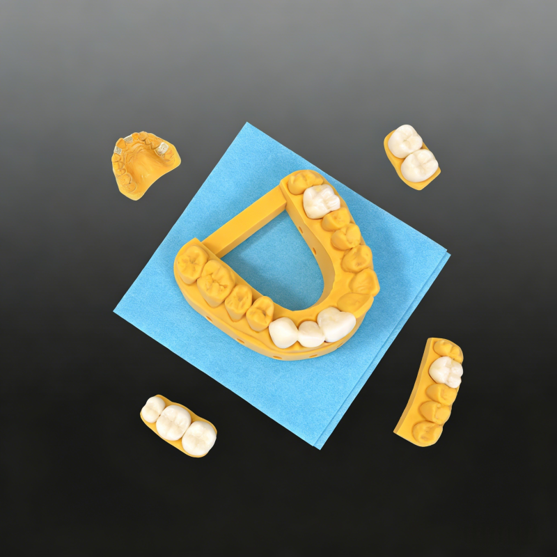 Bending Modulus 6500 Mpa Dental Ceramic Resins BL A2 A3.5 A1 A3 Materials for Creating Natural Looking Dental Restorations