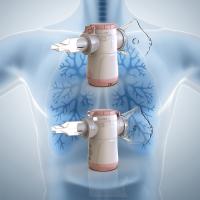 Nebulizer pour enfants de classe IIa plus efficace que le compresseur automatique