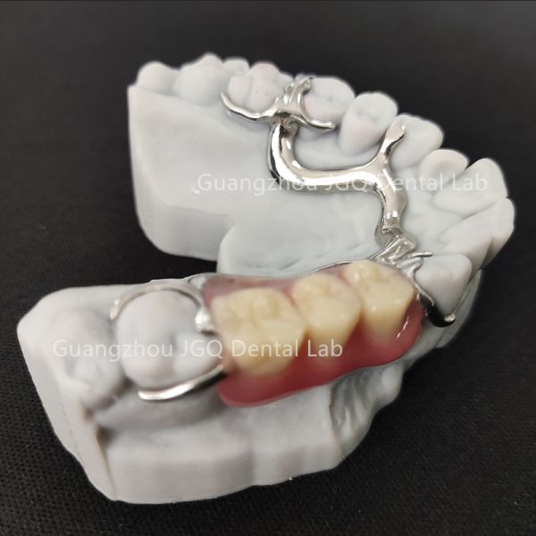 Lightweight Dental Framework Partial Dentures 3D Laser Printing Comfortable