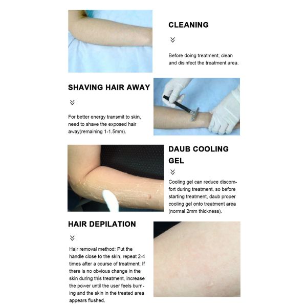 3 Wavelength Diode Laser Hair Removal Machine For Permanently Hair Removal