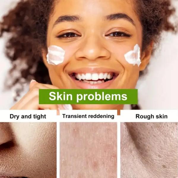 Hidratante Natural Vitamina E Aloe Vera Creme Facial Antienvelhecimento