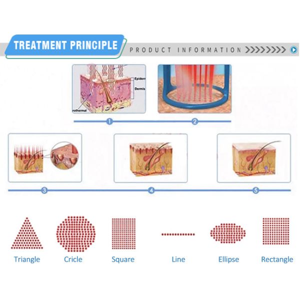 частичный лазер СО2 10600nm применяет обложку к Resurfacing лазер Yag эрбия машины