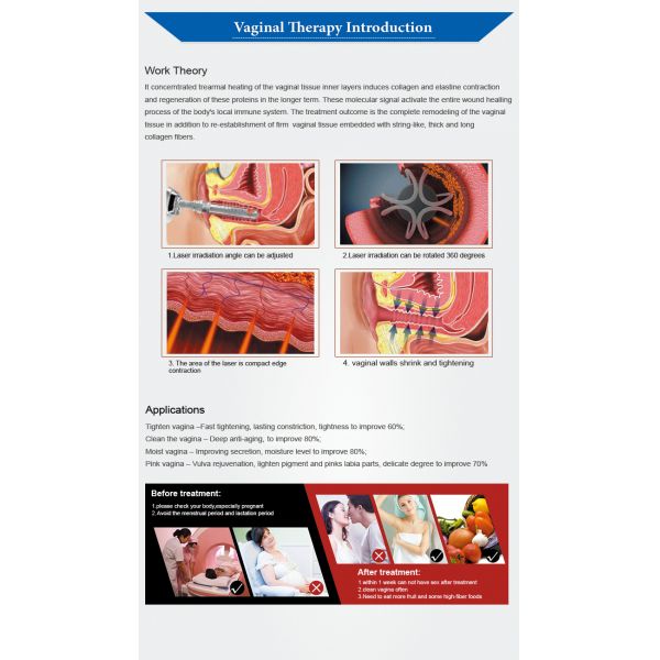 Rajeunissement partiel de laser Vaginal Tightening Equipment For Skin de CO2 de Fotona 4D