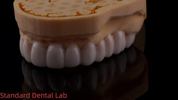 Appareils dentaires fonctionnels d' automne d' orthodontie du laboratoire dentaire chinois