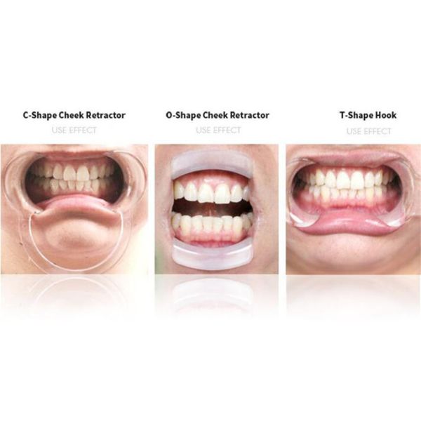 Autoclavable консервооткрыватель рта c зубоврачебных материалов формирует зубоврачебные зубы губы забеливая ранораширитель щеки