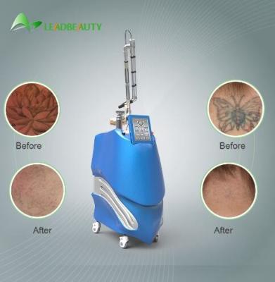 600ps pico second Nd:YAG laser for tattoo removal beauty equipment +86 18332565274