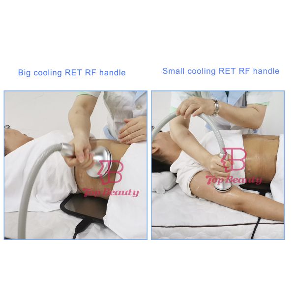 Ice Ret Cet Rf Skin Tightening Face Lift Machine Stationary