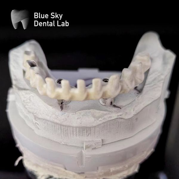 Cuadro de titanio Puente Malo Dental Implante de puente Malo personalizado