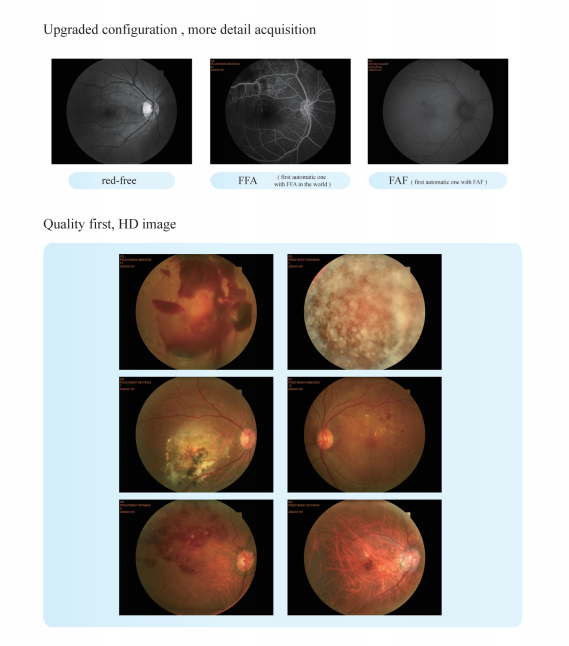 Камера Fundus точного автофокуса автоматическая 60 Mm с умным