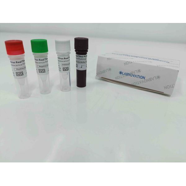 Real Time Monkeypox PCR Test Kit With Positive / Negative Control