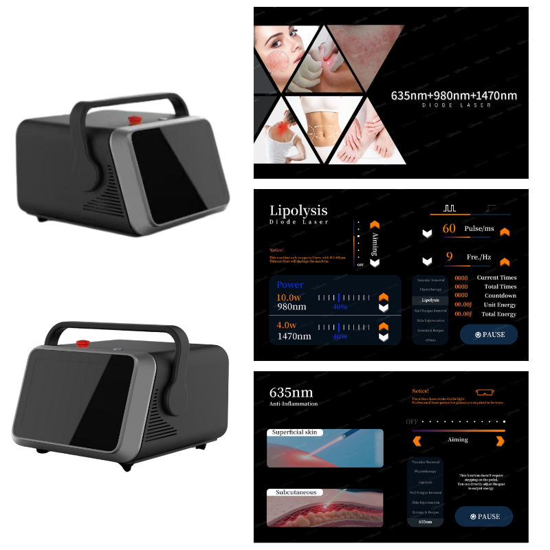 Triple Wavelength 1470nm 980nm 635nm Diode Laser System for Vascular Removal and EVLT Surgery Device