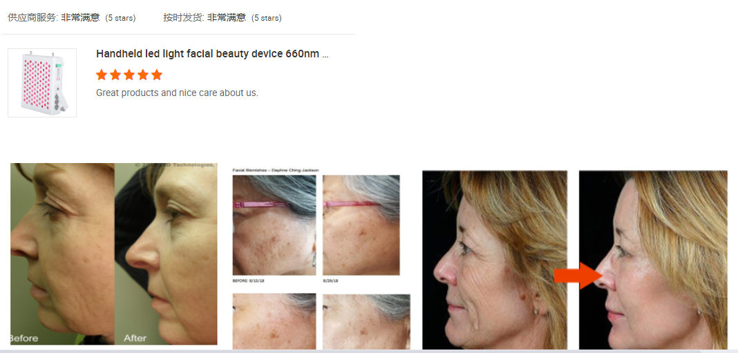 RED 660nm NIR 850nm LED Light Therapy Panel For Blemishes Redness