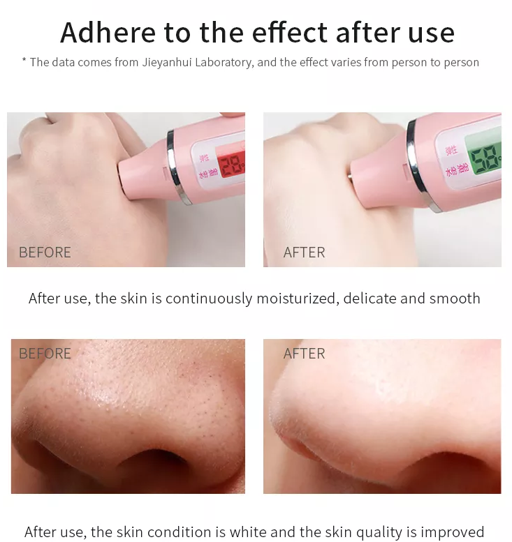 ОЭМ 300Г лицевая глиняная маска ежевики фруктово-кислотная глина угорь извлекать