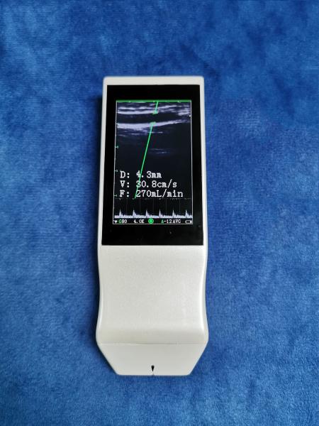 Wireless Linear Probe High Frequency Probe Special Tool for Visual Puncture Guidance Integrated Handheld Ultrasound Scanner