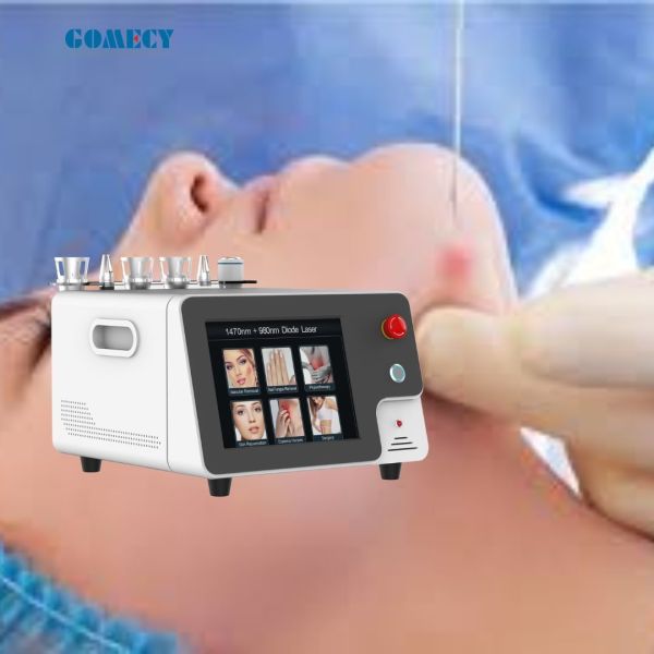 Máquina láser portátil de levantamiento de pulso con duración de pulso ajustable 980nm + 1470nm