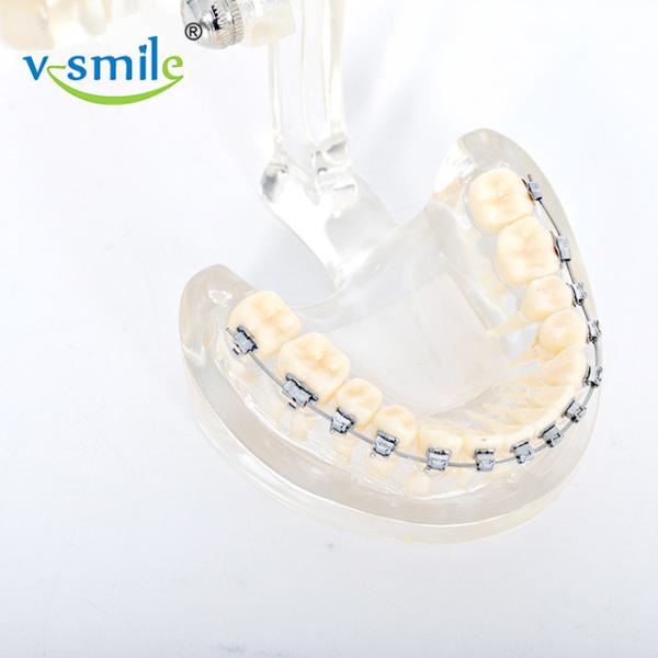 Stainless Steel MBT Orthodontic Metal Brackets 0.022'' 0.018''