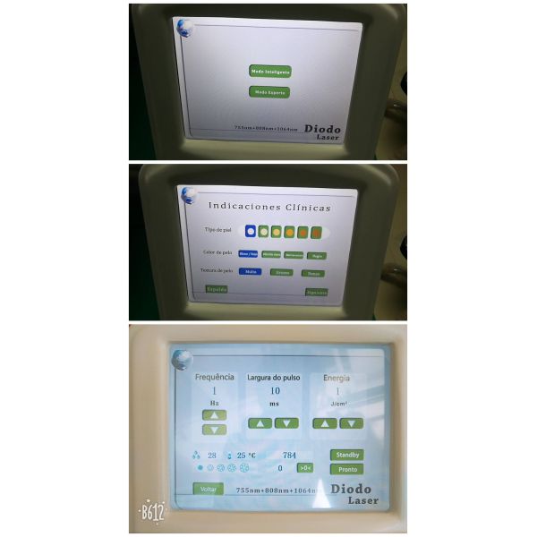 Máquina de depilación por láser de diodo portátil de alta potencia 755nm 808nm 1064nm 3 longitud de onda