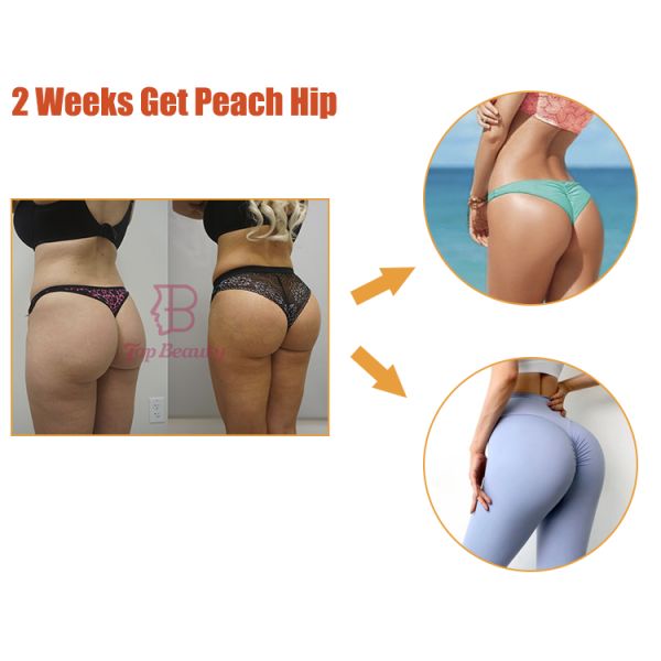 Чашки Xl терапией вакуума машины портативного батта вакуума подъема батокса поднимаясь