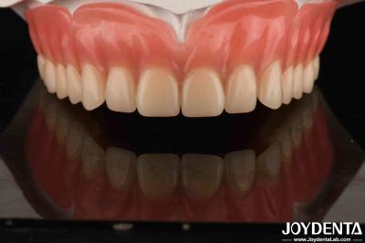 Acrylic Teeth Finish Lightweight Resin Material Dental Restorations Tooth Arrangement