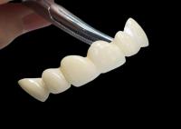 Coroa dental de zircônio translúcida personalizada com alta durabilidade resistente a manchas do laboratório dentário da China
