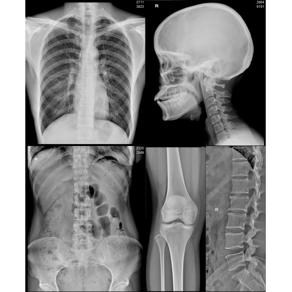 180 микронов фильма A3 струйного сухого отображая x Рэй медицинского для принтеров Epson канона