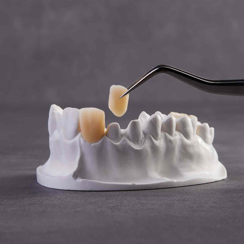 High-Translucency Multilayer Zirconia Block Superior Strength Natural Aesthetics