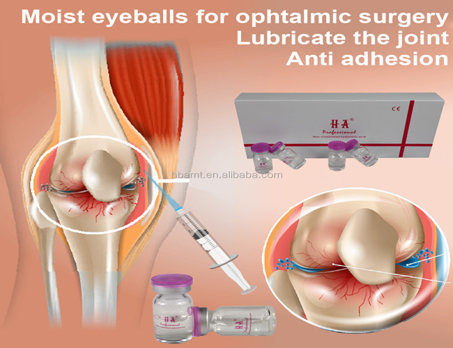 Hyaluronic кисловочный заполнитель впрыски 5mlX7 для колена не crosslink