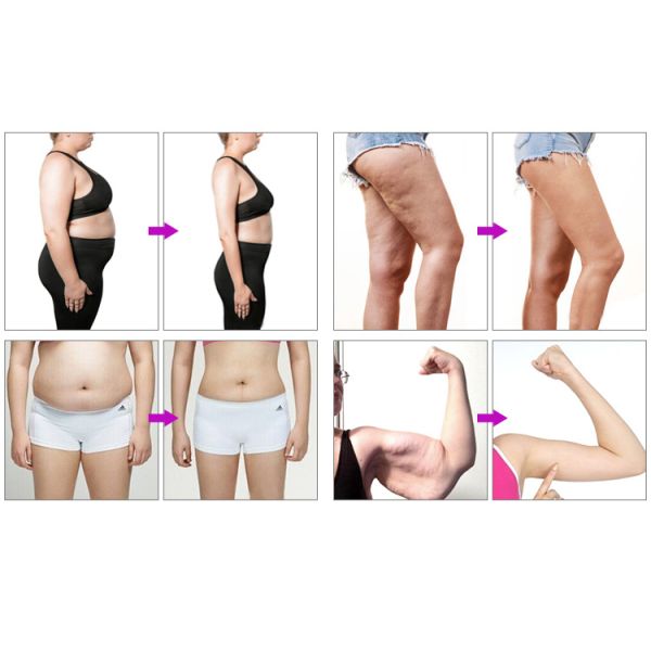 Ботинки спасения спорт массажируют дренаж машины Pressotherapy сжатия воздуха лимфатический