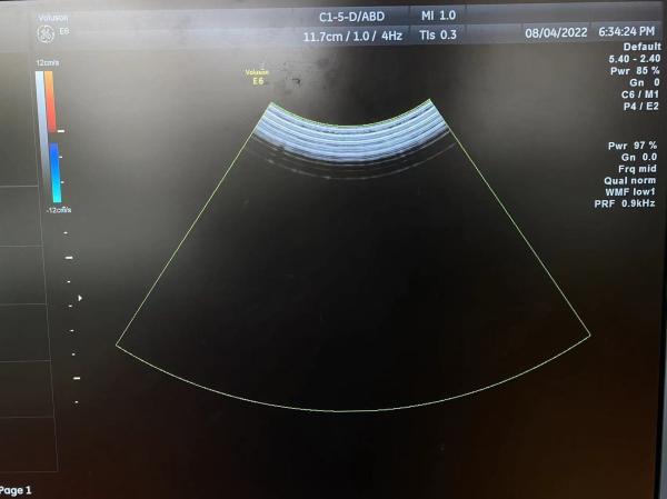 GE Logiq S7 コンベックス配列 オリジナル超音波トランスデューサー探査機 C1-5-D
