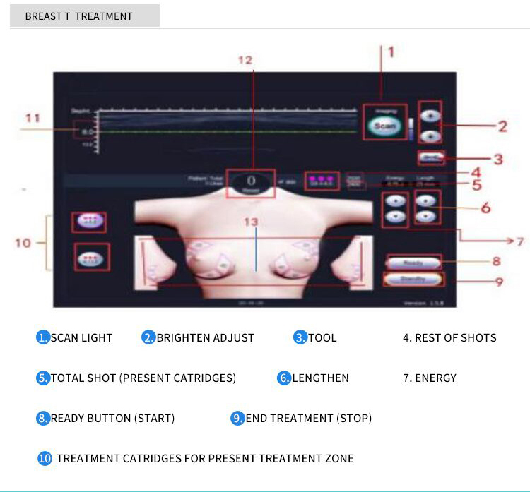 Liposonix Hifu уменьшая портативную машинку машины красоты для тела салона формируя 8mm 13mm