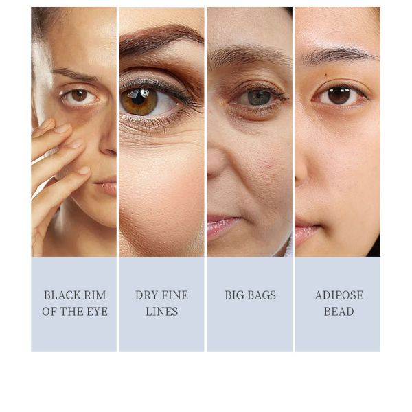 30G Retinol Eye Cream Dark Under Eye Circles Instant Fast Anti Aging Anti Wrinkle Remover Eye Bag