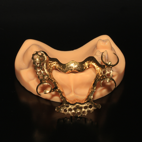 Anodized 3D Printed Titanium Framework Lightweight For Sensitive Skin